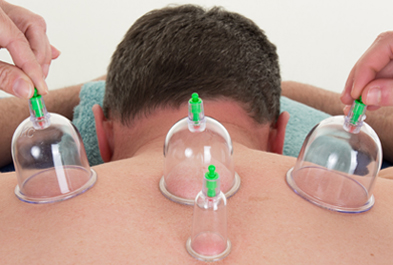 Cupping11